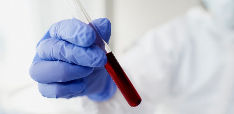 (Fot. materiał partnera)