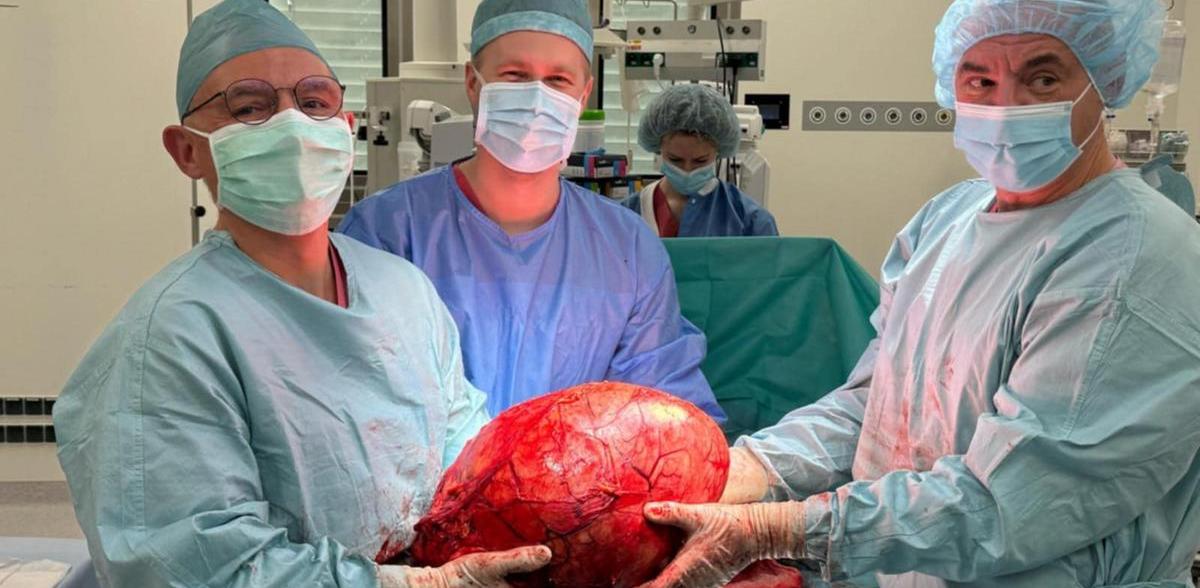 Guz o rozmiarach 35x26x26 cm uciskał istotne dla życia narządy (Fot. mat. pras. Copernicus)