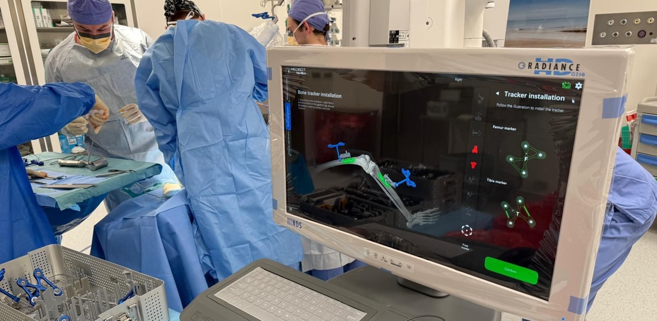 Operacja wszczepienia implantu stawu kolanowego Evolution 2 medial pivot za pomocą robota MicroPort SkyWalker w Szpitalu Specjalistycznym im. Floriana Ceynowy w Wejherowie (fot. mat. pras.)