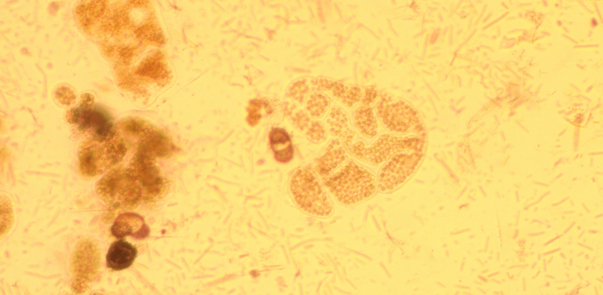 Zdjęcia wykonane pod mikroskopem przedstawiające sinice obecne w próbkach (fot. Facebook/Centrum Monitoringu i Ochrony Wód Uniwersytetu Gdańskiego)