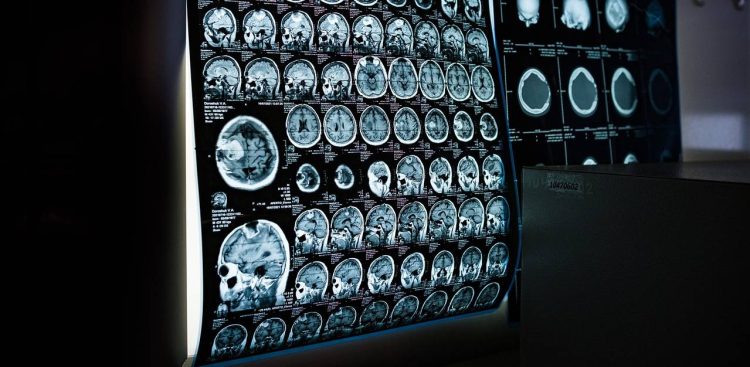 Zdjęcie ilustracyjne (fot. pixabay.com)