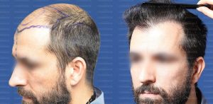 (fot. mat. sponsorowane)