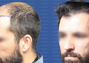 (fot. mat. sponsorowane)